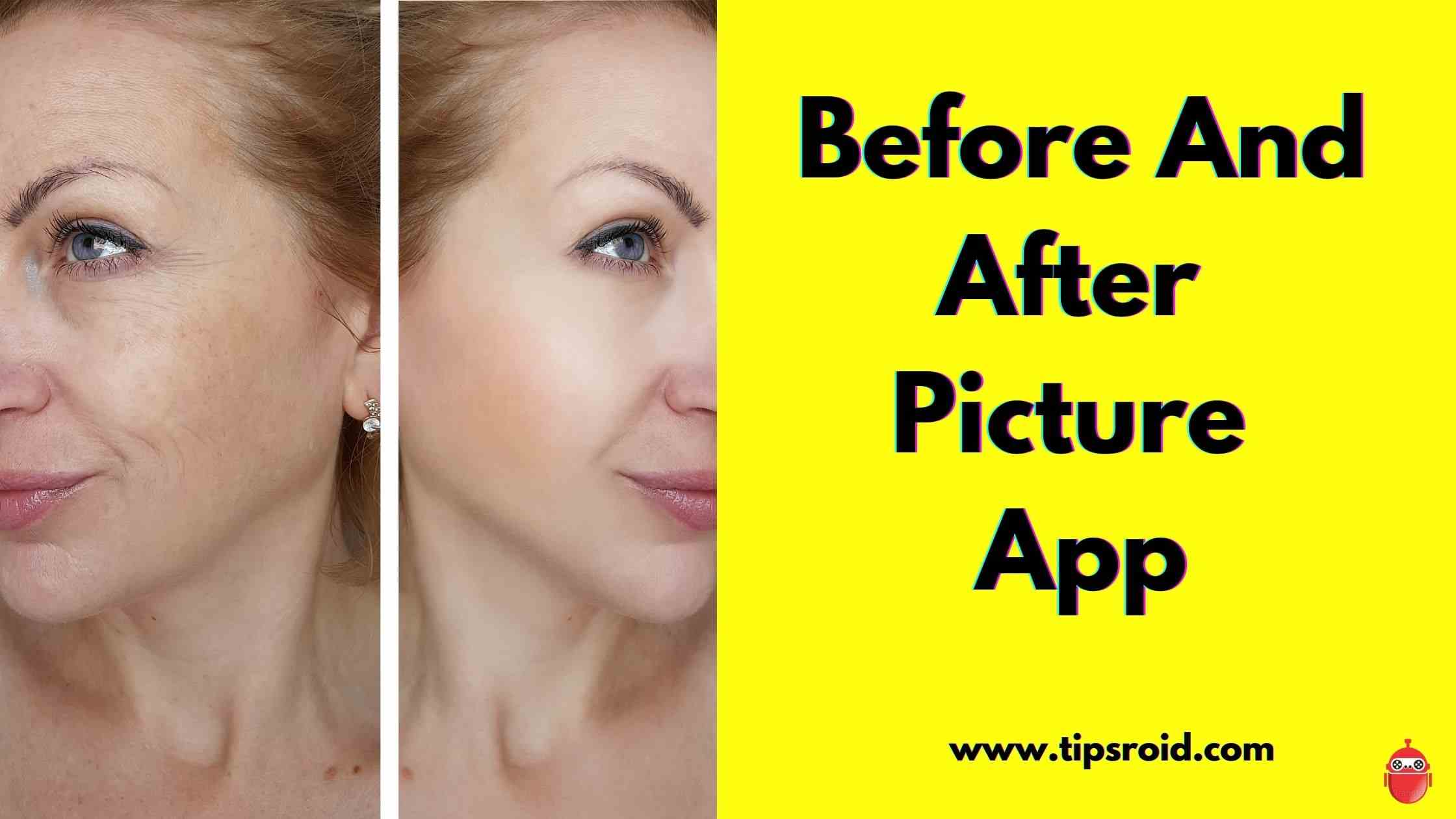 Before And After Picture App